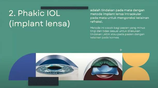 Phakic IOL implant lensa